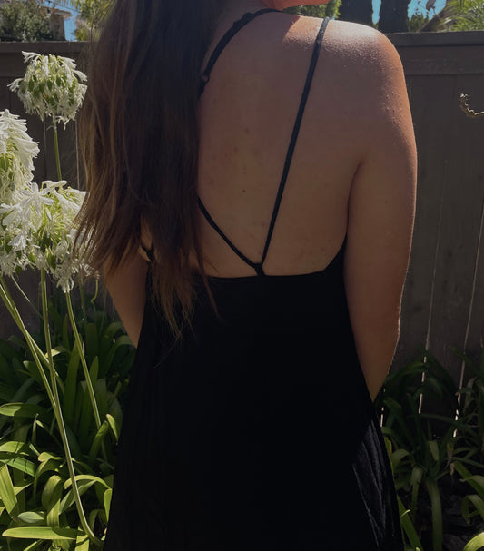 Bloom Backless Minidress